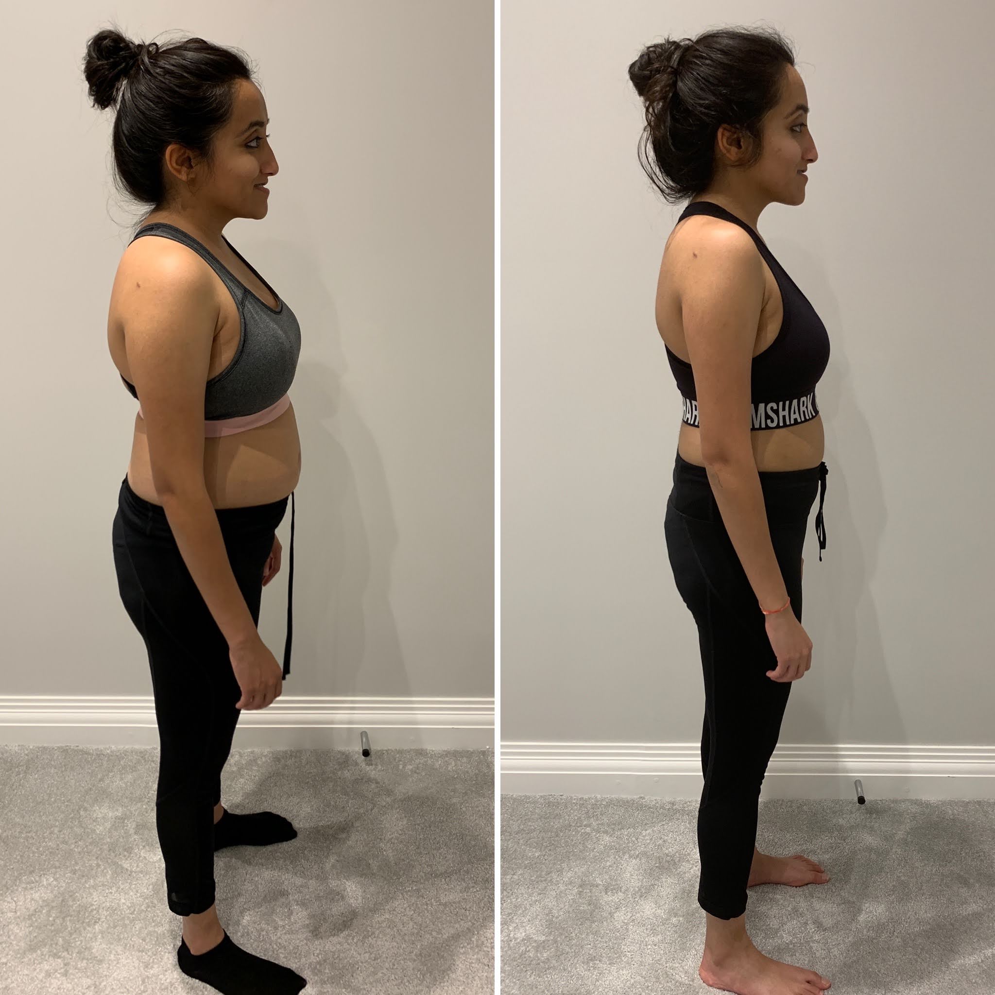 Shreya L before and after